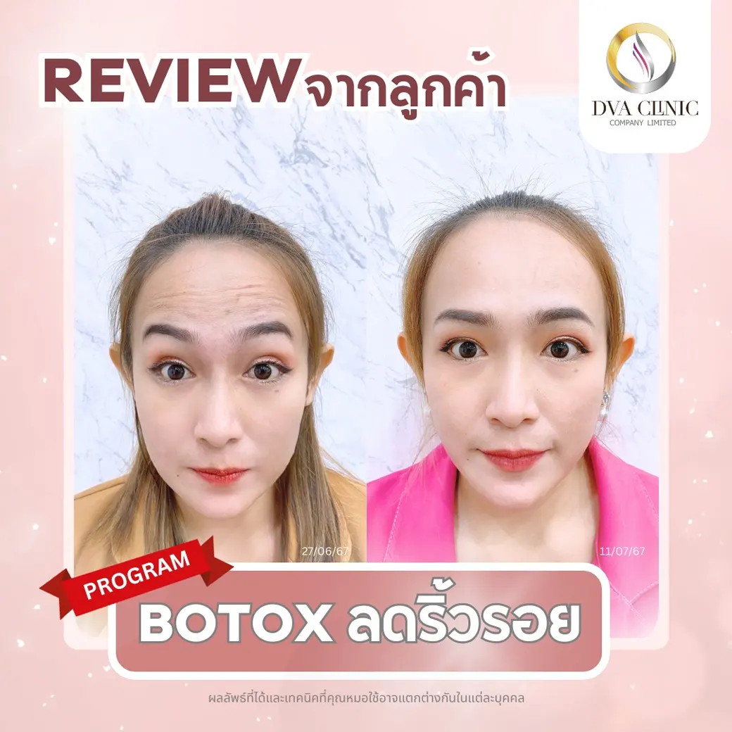 รีวิวจากลูกค้า DVA Clinic